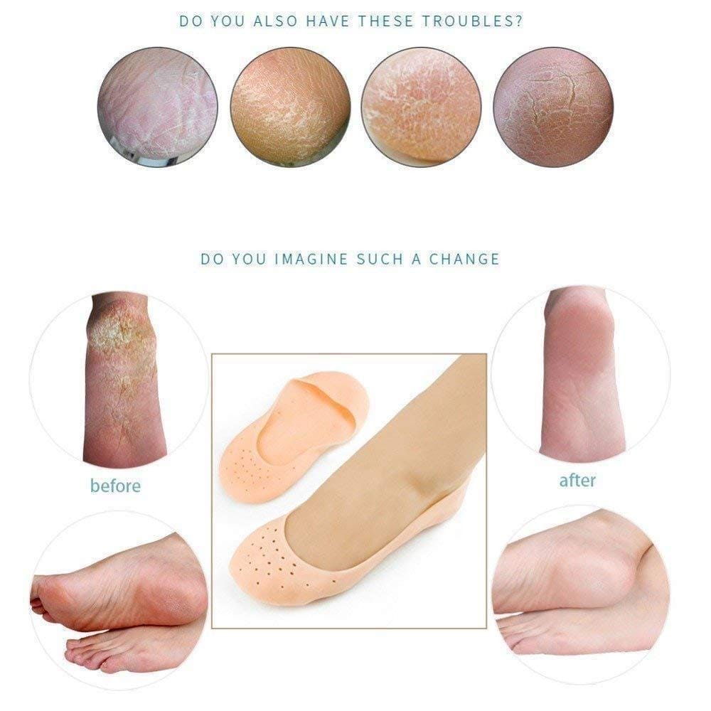 Full Silicon Gel Socks, Anti Crack Heel Socks, Moisturizing Socks For Foot Care And Heel, Full Length Silicone Foot Protector, Cracked Heel Treatment Socks, Men And Women Gel Heel Protectors Full Silicon Gel Socks, Anti Crack Heel Socks, Moisturizing Socks For Foot Care And Heel, Full Length Silicone Foot Protector, Cracked Heel Treatment Socks, Men And Women Gel Heel Protectors